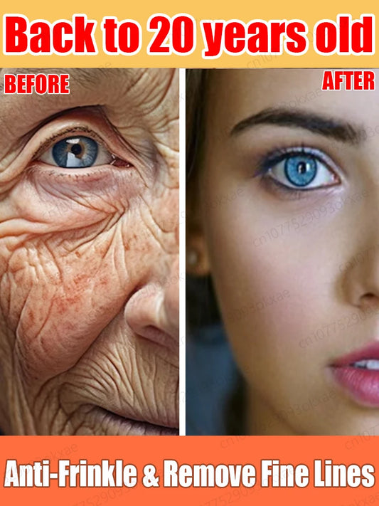 Anti Wrinkle Aging Instant Effect Remove Facial Wrinkles